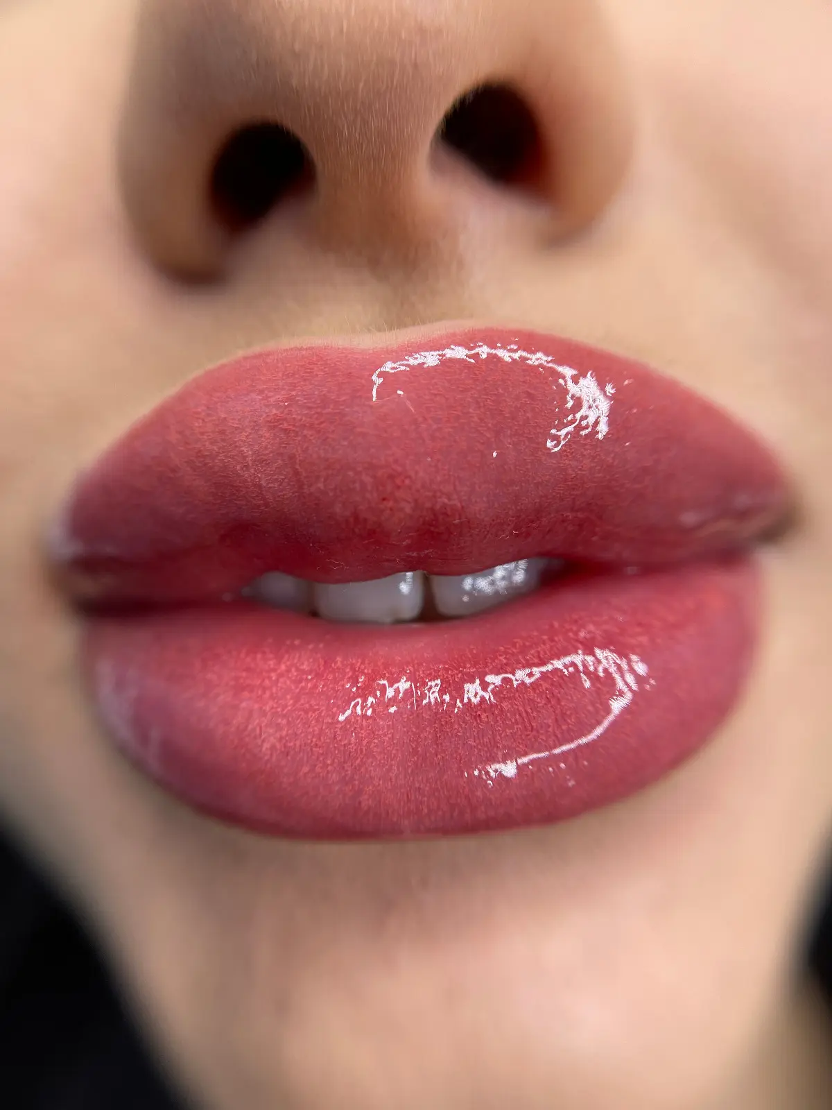 Micropigmentare Buze - Înainte și După 11